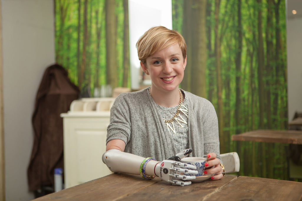British woman receives “world’s most lifelike bionic hand”